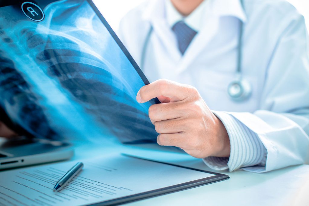 doctor examing an x-ray