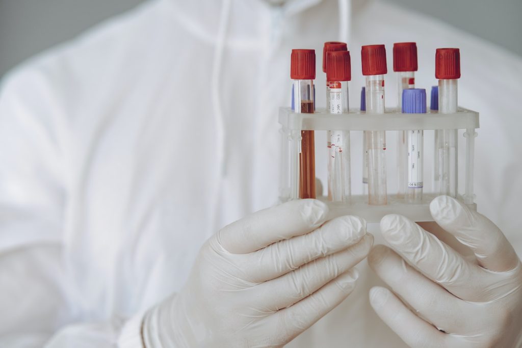 COVID-19 Antibody Testing: What You Need to Know